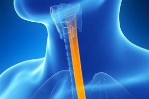 5 natuurlijke remedies tegen slokdarmontsteking