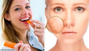 Ontdek 9 voedingsmiddelen voor de verzorging van de huid