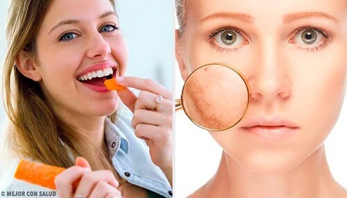 Ontdek 9 voedingsmiddelen voor de verzorging van de huid