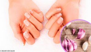 Zelfgemaakte remedies om je nagels te hydrateren
