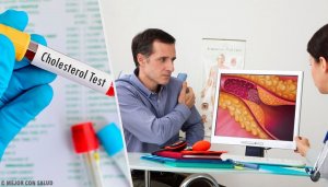 Waarom is cholesterol een risicofactor?