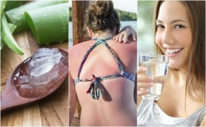 9 manieren om zonnebrand te behandelen