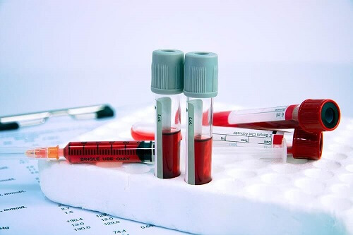 De effecten van een laag hemoglobinegehalte