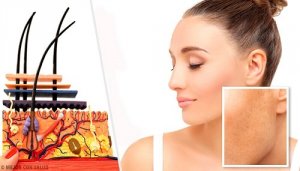 Soorten huidvlekken en wat de mogelijke oorzaken zijn