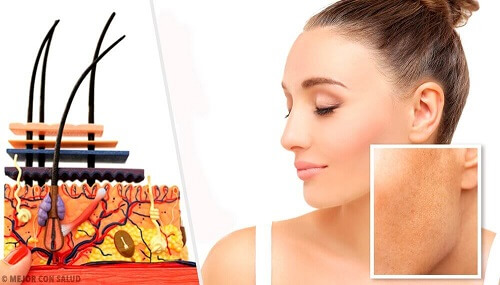 Soorten huidvlekken en wat de mogelijke oorzaken zijn