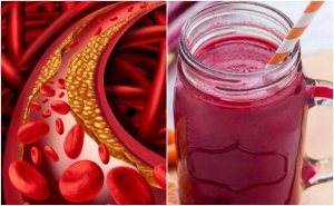 Je cholesterol onder controle houden met deze bietensmoothie