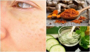 Ouderdomsvlekken uitstellen met natuurlijke remedies