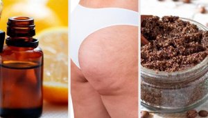 Natuurlijke remedies om cellulitis te verminderen