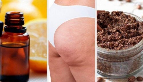 Natuurlijke remedies om cellulitis te verminderen