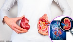 5 dingen die je moet weten over niertransplantaties