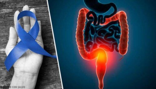 Rood vlees en kanker