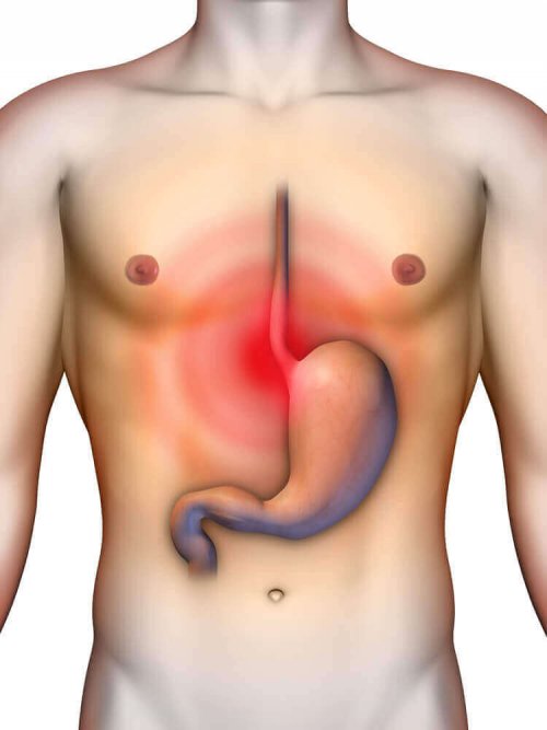 4 natuurlijke maagzuurremmers om reflux te behandelen