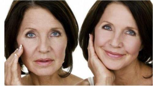 Voor en na foto's van vrouw met stevigere huid