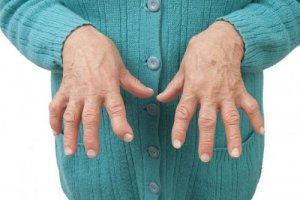 Reumatische artritis verlichten met geneeskrachtige remedies