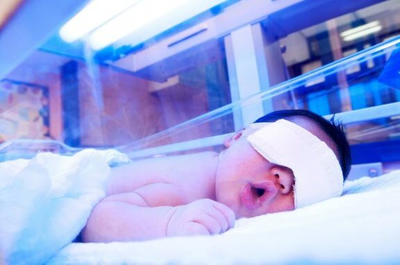 Lichttherapie tegen geelzucht bij baby's