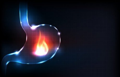 wat is brandend maagzuur