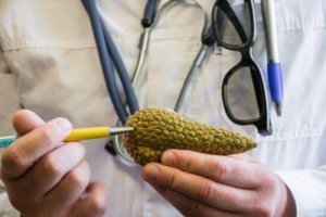 De eerste hormonale symptomen van alvleesklierkanker