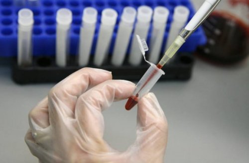 Kan stamceltransplantatie HIV uitroeien?
