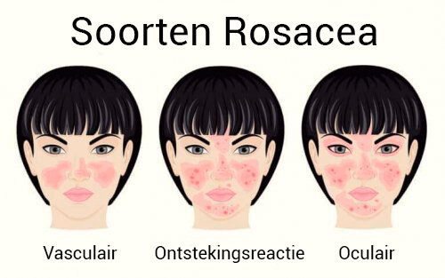 rosacea kan niet genezen