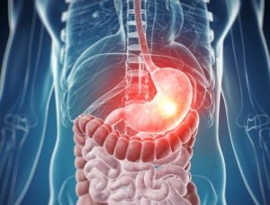 Wat zijn de bekendste vormen van voedselintolerantie?