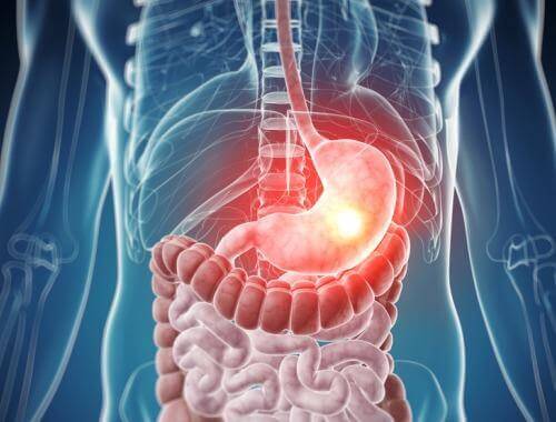 Wat zijn de bekendste vormen van voedselintolerantie?