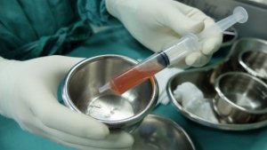 Ascites: informatie en stappen om het te behandelen