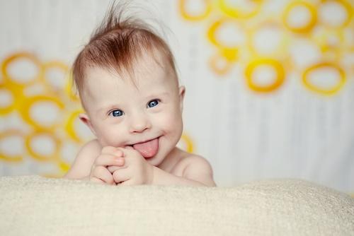 Een baby met het syndroom van Down