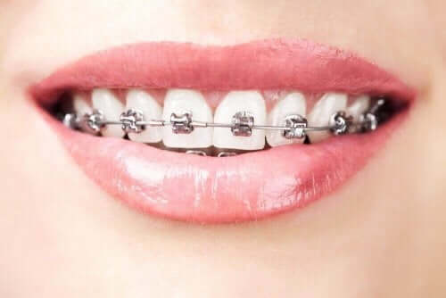 Orthodontie