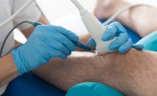 Test om knieartrose te diagnosticeren
