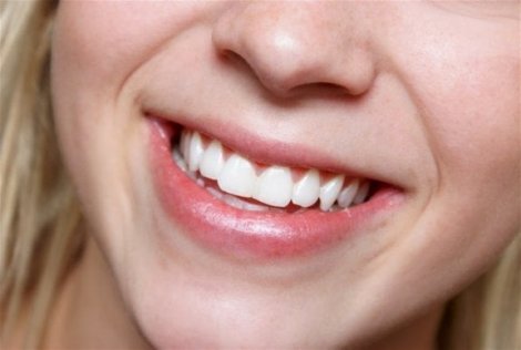 Natuurlijke producten om tanden te bleken