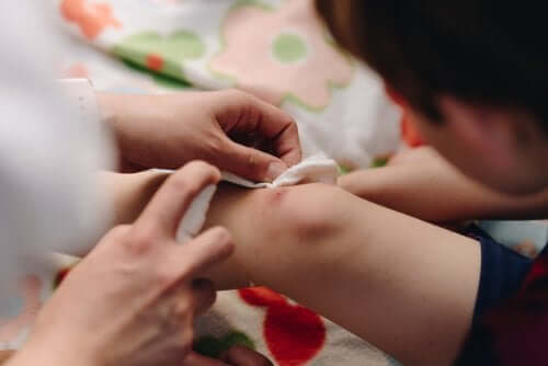 Hoe kun je de genezing van een grote wond stimuleren