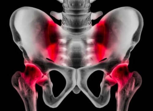 Atletische pubalgie: oorzaken, symptomen en behandeling