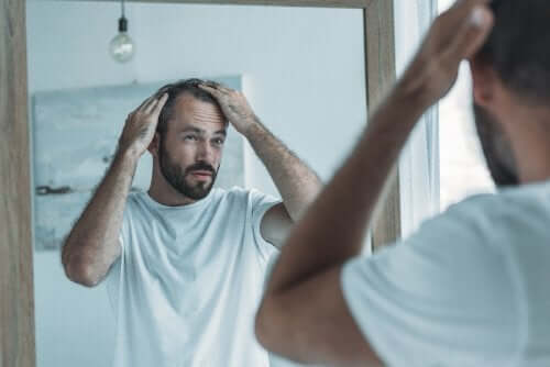 Man met alopecia
