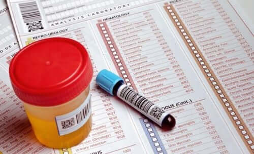Urinetest