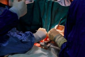 Leer alles over een aortadissectie