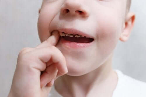 Kind met gaatjes in de tanden