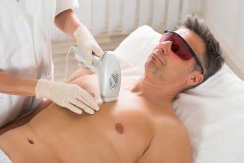 Een man krijgt laserontharing toegepast op de borst