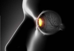 Scheelheid: symptomen en behandelingen