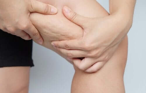 Iemand laat cellulite op been zien