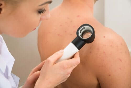 Dermatoloog bekijkt de huid van iemands rug