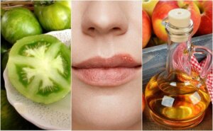 5 natuurlijke remedies om een koortslip te bestrijden