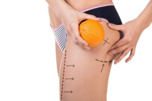 3 menu's voor de preventie van cellulite