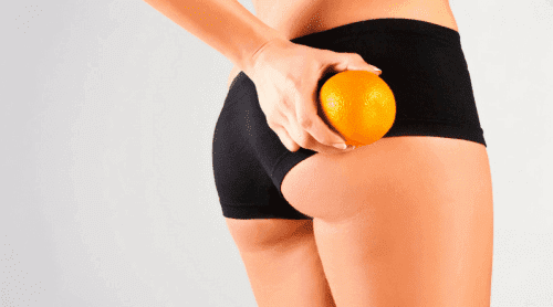 Strakke huid versus sinaasappelhuid