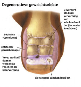 Oorzaken en behandeling van degeneratieve gewrichtsziekte
