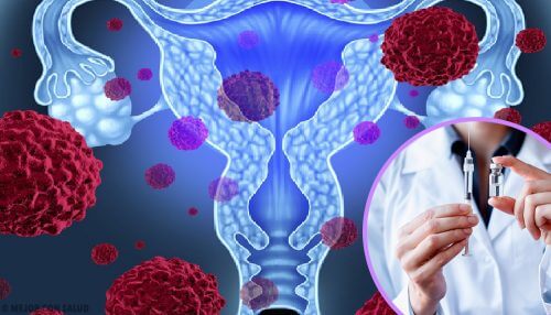 Alles wat je moet weten over HPV