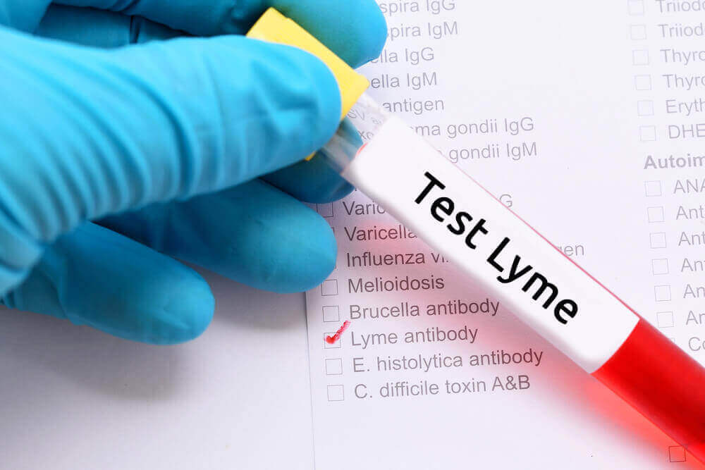 Bloedtest voor de ziekte van lyme