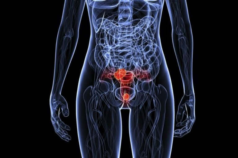 Plaatje waar HPV in het lichaam kan zitten