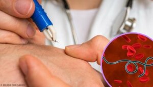 Symptomen van de ziekte van Lyme