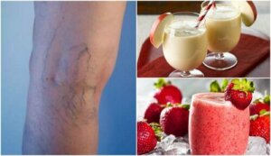 Smoothies om spataderen te verminderen