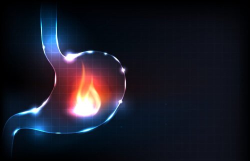 De belangrijkste oorzaken van brandend maagzuur